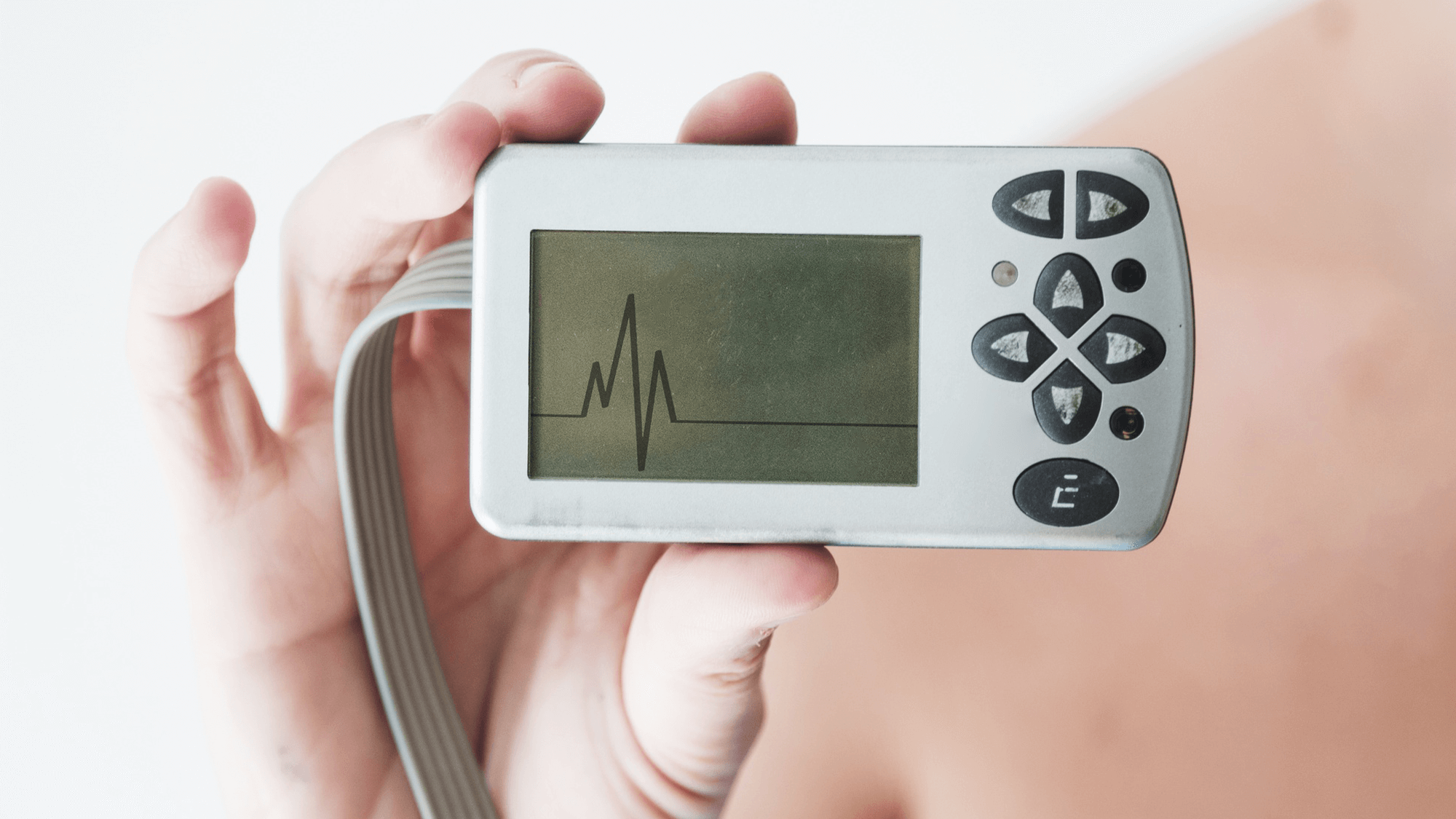 Électrocardiogramme